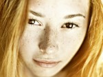 woman with freckled