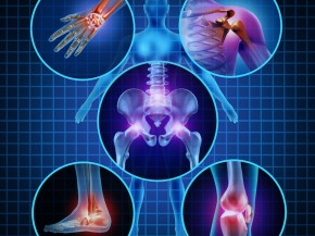 Painful Joints