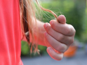 wypadanie-włosów-600